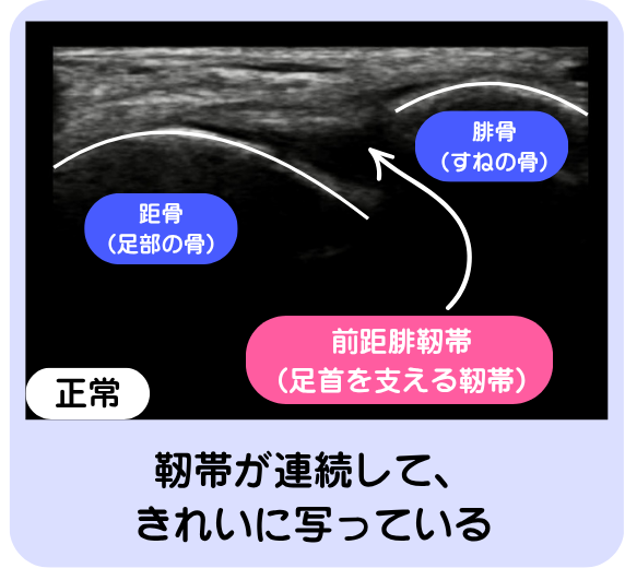 エコー検査