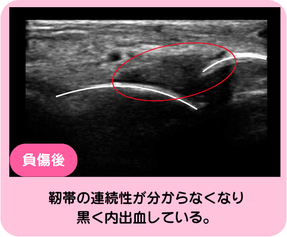 エコー検査